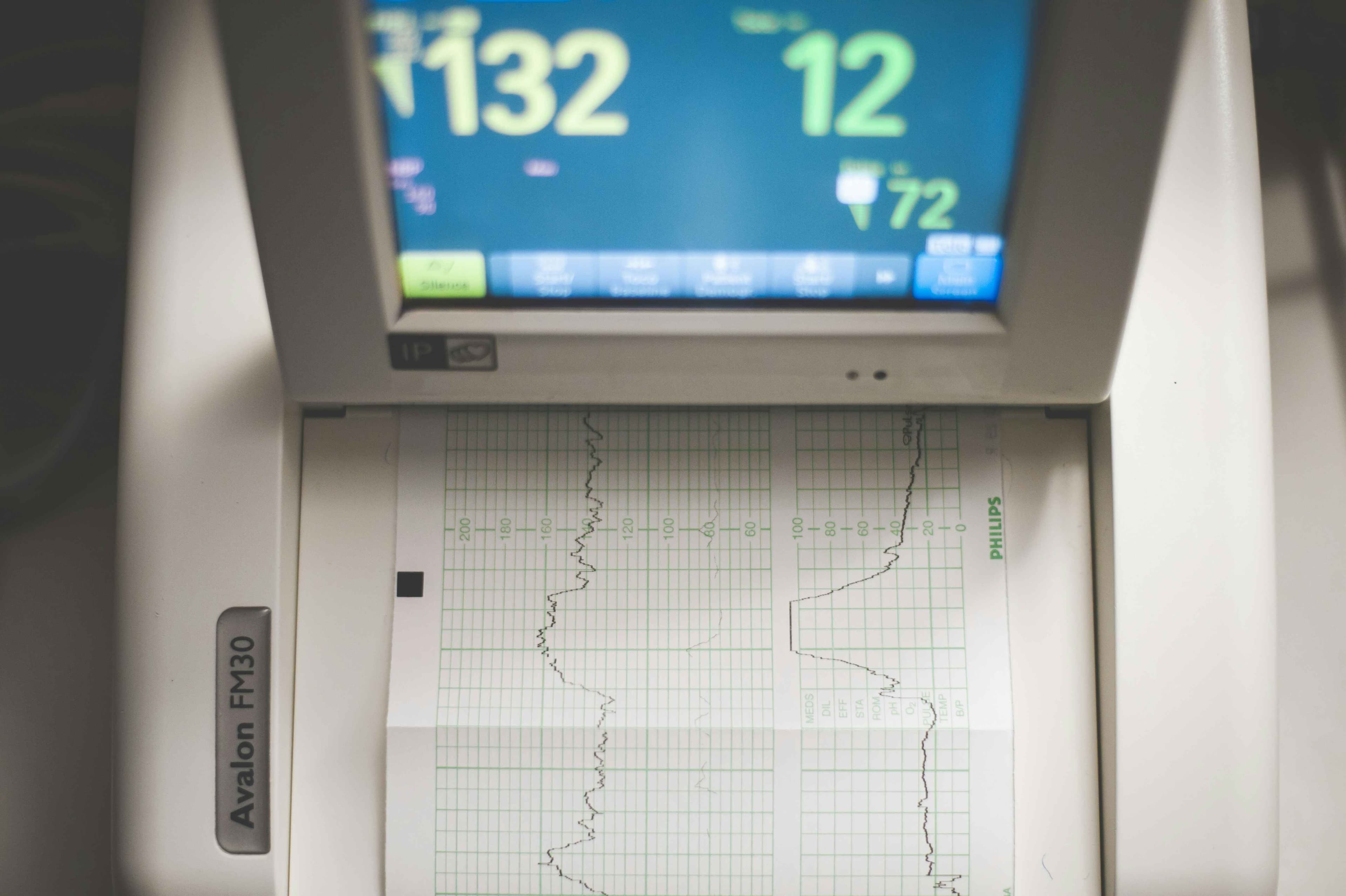 Wilmington Health Service: Electrocardiogram